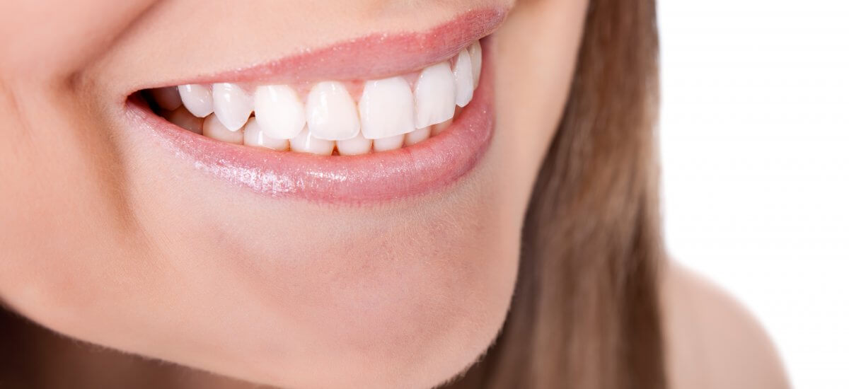 ¿Cuánto tardo en hacer un tratamiento de estética dental?