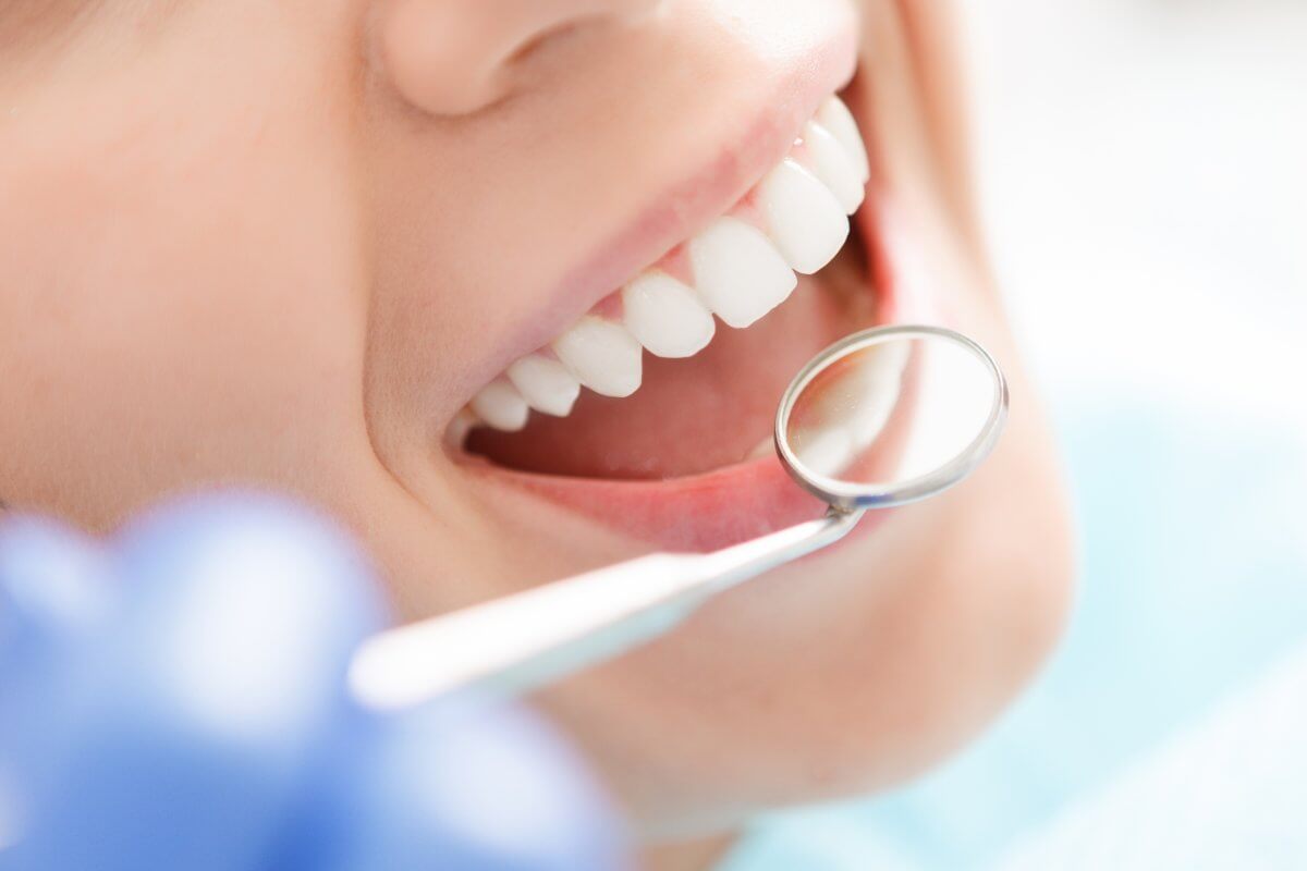 ¿Por qué es imprescindible la revisión dental tras las vacaciones?