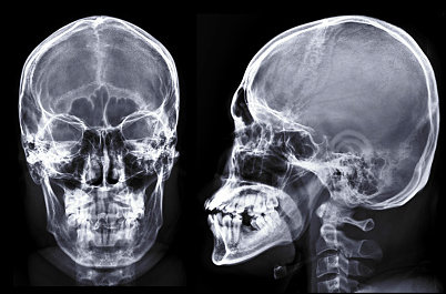 radiografialateralyfrontal